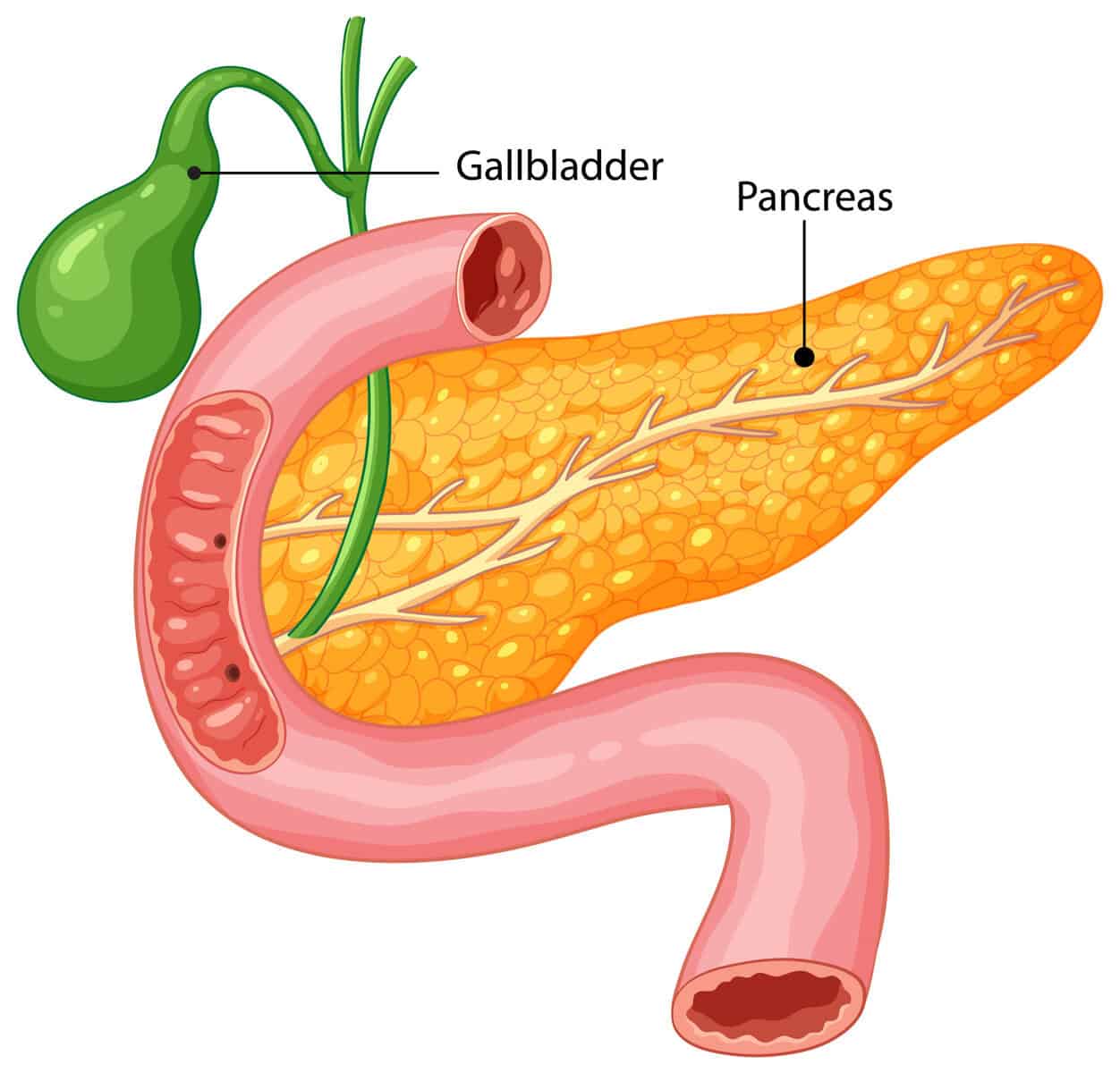 GALLBLADDER-SUPPORT